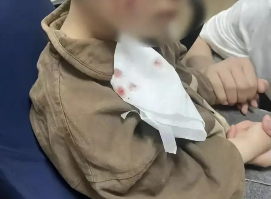 河南南阳，三岁男童被狗咬了，18天后不治身亡，令人揪心，难受。

现在生活条件好