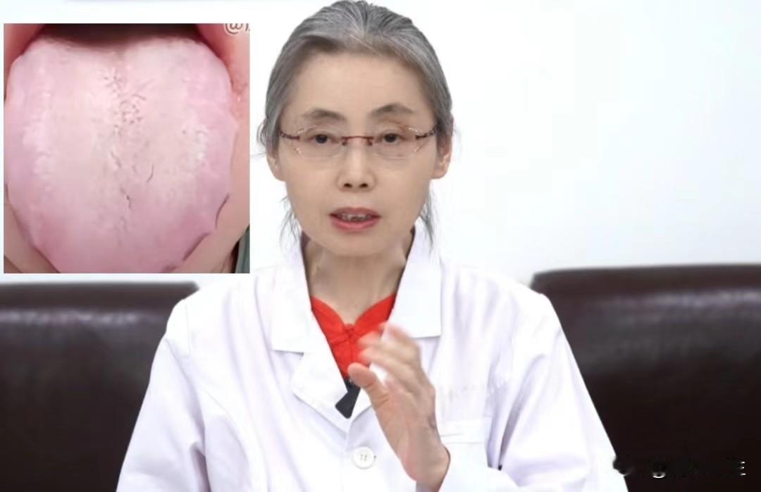 舌苔白，别再用桂附地黄丸了，除去寒湿才是重点

患者主诉：头晕，怕冷，痰多，嘴里
