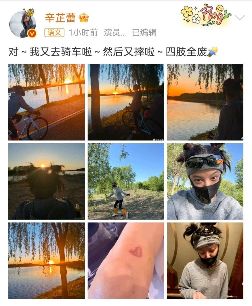 辛芷蕾腿摔出爱心辛芷蕾晒爱心伤疤 辛芷蕾晒腿上爱心伤疤 