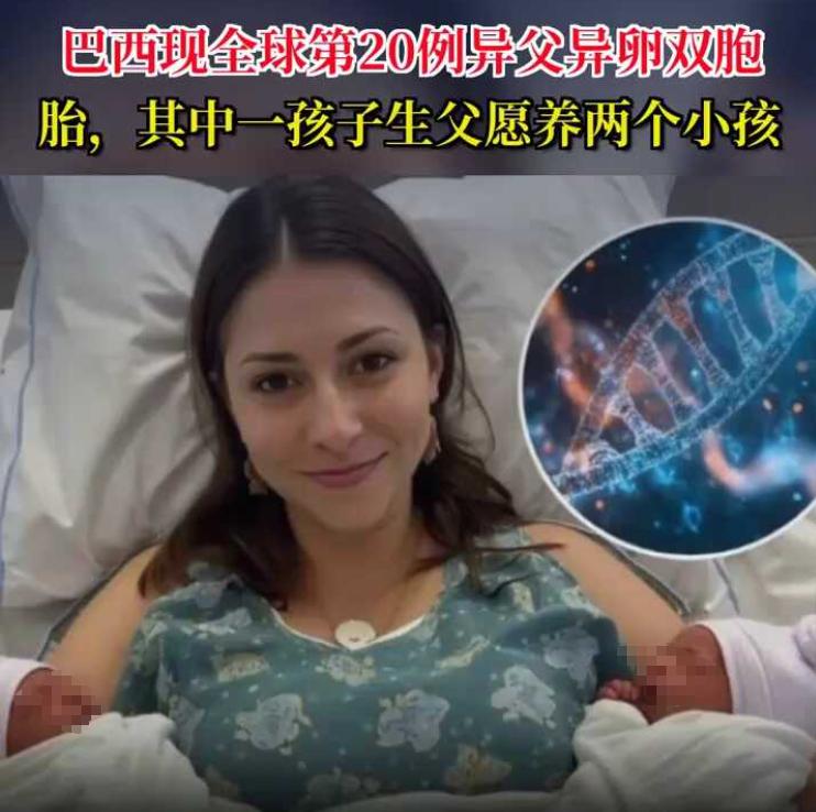 巴西曾发生了一件匪夷所思的事情，一名女子先后与两名男子发生了关系，怀孕后生下了一