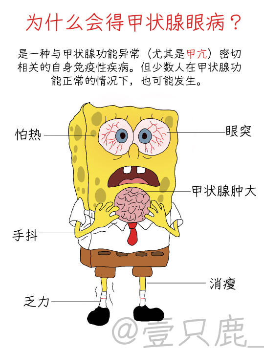 世界甲状腺日-小心免疫系统“误伤”眼睛