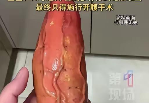 离谱至极！

    61岁大叔轻信偏方，

   硬生生把自己送进手术室
 