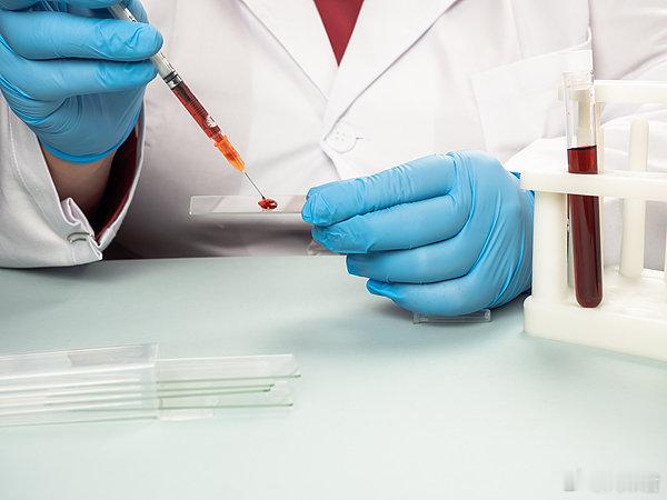 【比“熊猫血”还罕见！ 海南发现1例稀有恐龙血 】 海南一献血者被发现为稀有恐龙