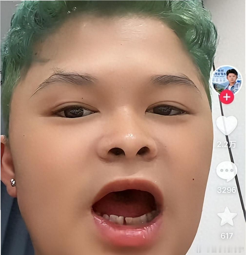 小马云13岁确诊智力二级残疾一眨眼，小马云的18岁了，看面容还跟个小孩一样，不过