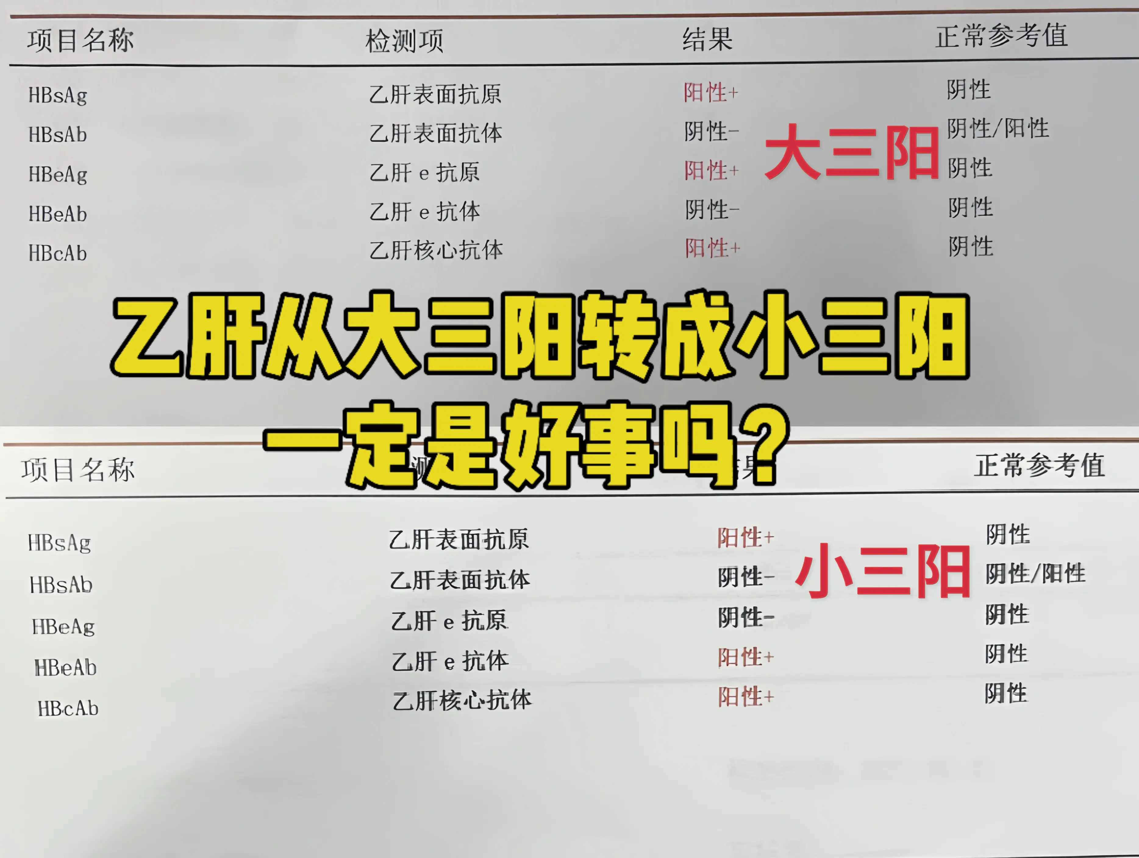 乙肝大三阳转小三阳很多人都认为是一件好事，代表着病情好转，但这并非绝对...