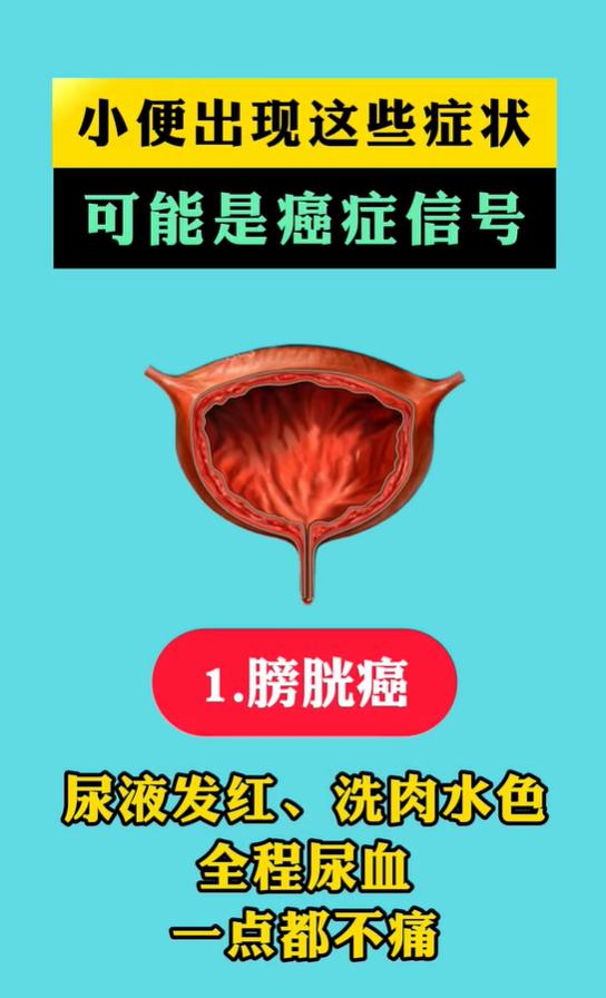 血尿夜尿多腰胀，三种尿路不适信号科普