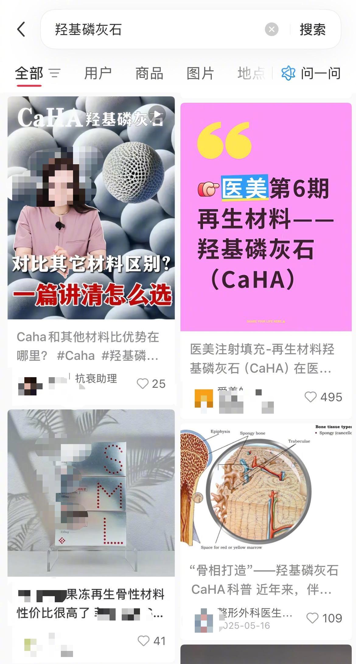 【#消协提醒羟基磷灰石面部注射风险#！曾有消费者隆鼻填充后过敏】注射材料羟基磷灰