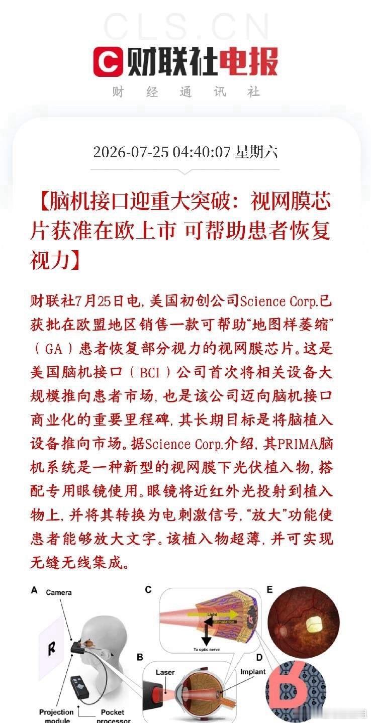 周末，脑机接口传出商用的消息，A股相关概念下周有望反弹美国研发脑机接口设备的企业