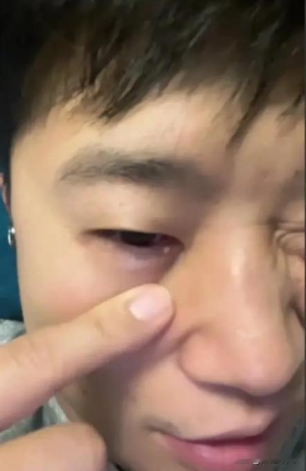 坏了！中国射击队来到印度参加比赛，没成想，比赛第一天就“中招了”，已经有运动员被