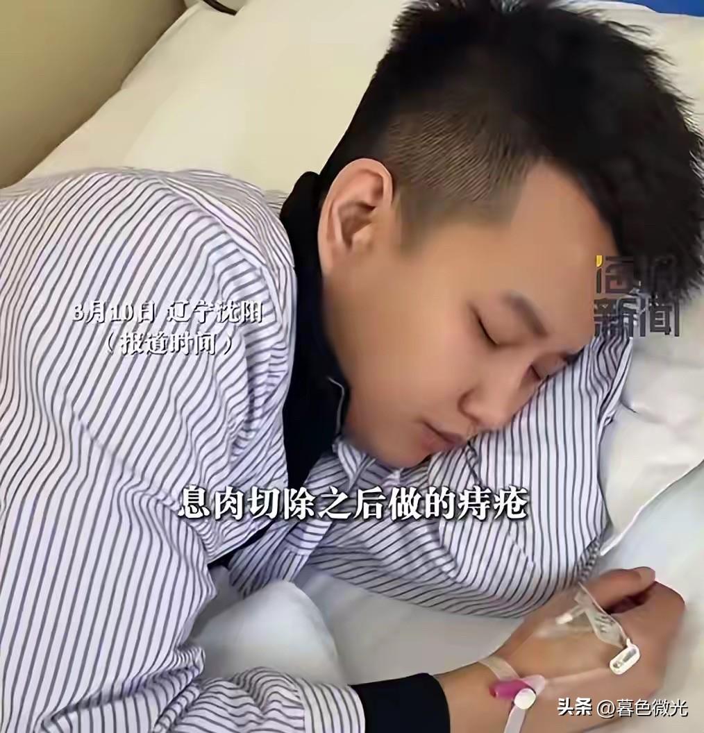 沈阳29岁男子一周内连做五场手术，先切除肠息肉，又做了痔疮、包皮和挖痣手术，最后
