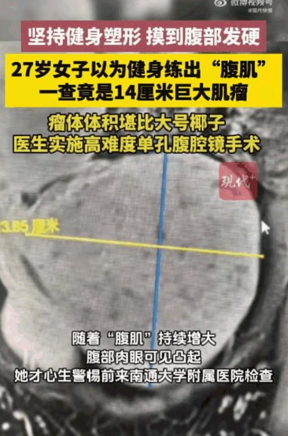 “警惕身体给出的信号！”江苏南通，一个27岁的姑娘，满心欢喜地以为自己卷出了人人