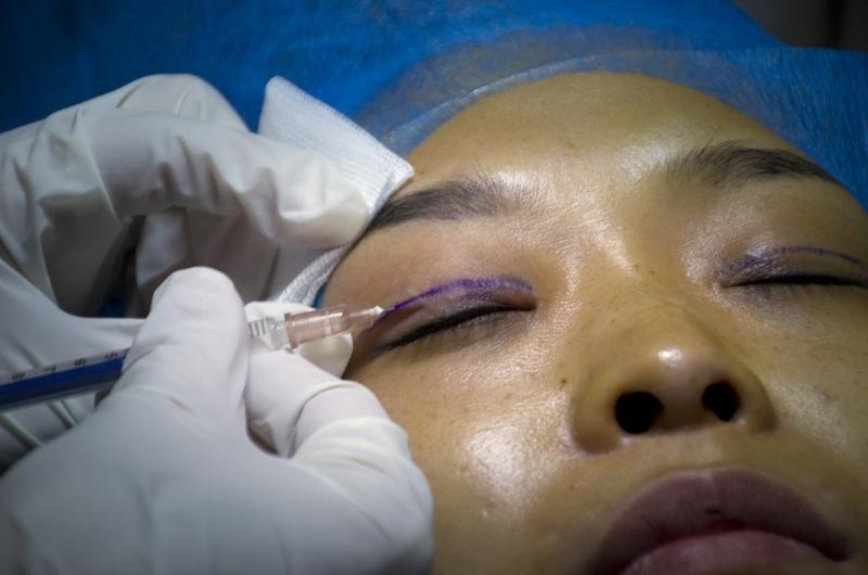 吓哭！双眼皮术后眼睛闭不上，凌晨流泪疼醒，卫健委突击查处黑幕
 
“本想割个双眼