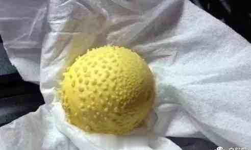 简单实用的民间外治法——滚鸡蛋（收阴术）社会上流传着不少“滚鸡蛋”的方法、效果反