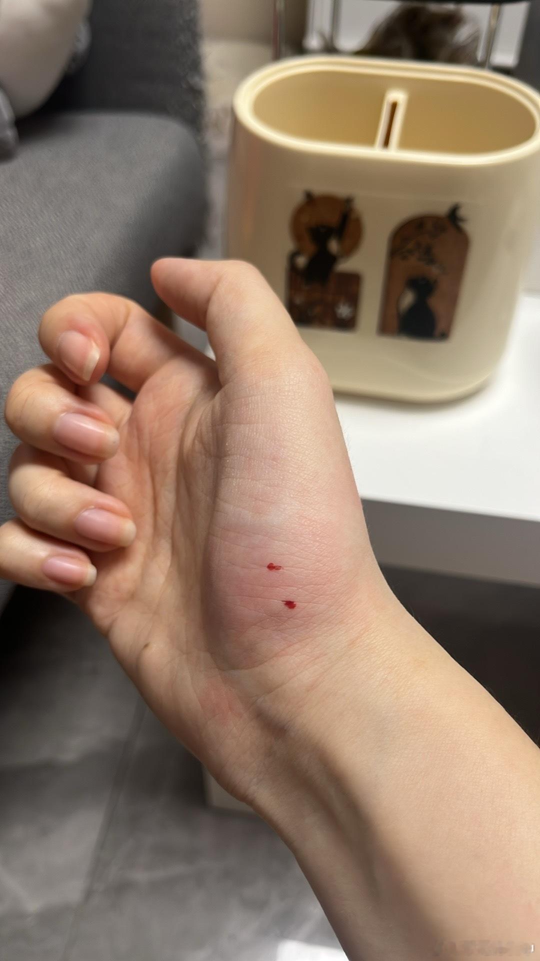 被坏猫揍了迅速肿起来 