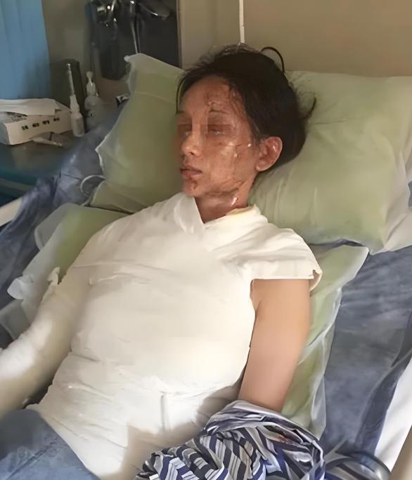 这就是嘴欠的下场！浙江女子吃火锅肆意辱骂服务员，被热水大面积烫伤
真的印证了那句