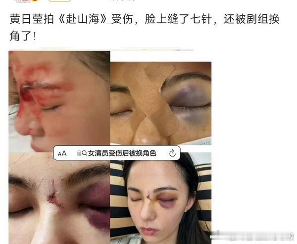 原来黄日莹才是原来演赴山海官配角色的那个 当时小黄提前进组训练受伤，脸缝了七针，