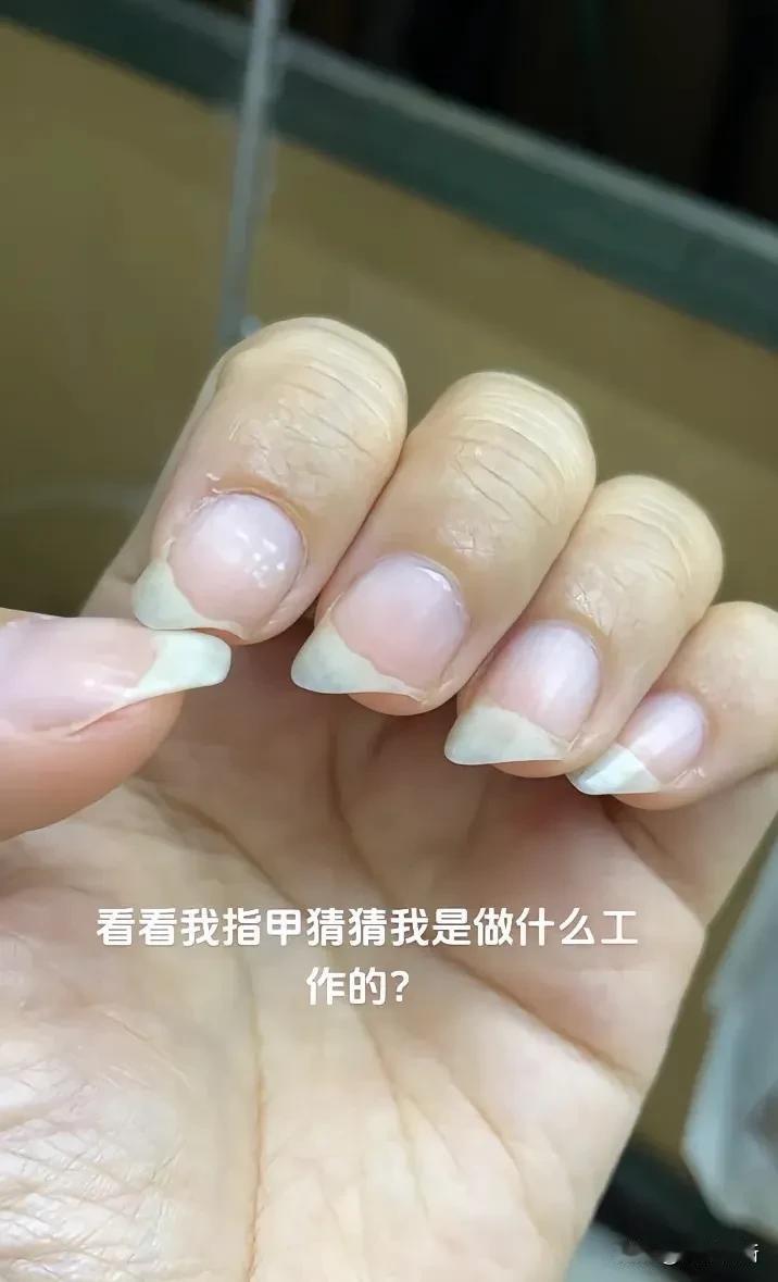 干活的手，看我指甲猜猜我干的什么工作？
#干活保护好双手# #这个手闲不住# #