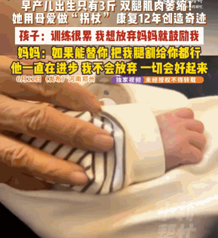 母爱太伟大了！河南，一3斤早产儿一出生就面临双腿肌肉萎缩的绝境。日复一日的康复训
