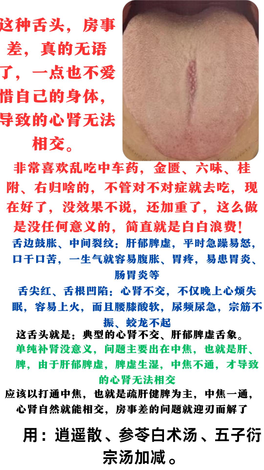 这种舌头，房事差，真的无语了，一点也不爱惜自己的身体，导致的心肾无法相交。
舌边