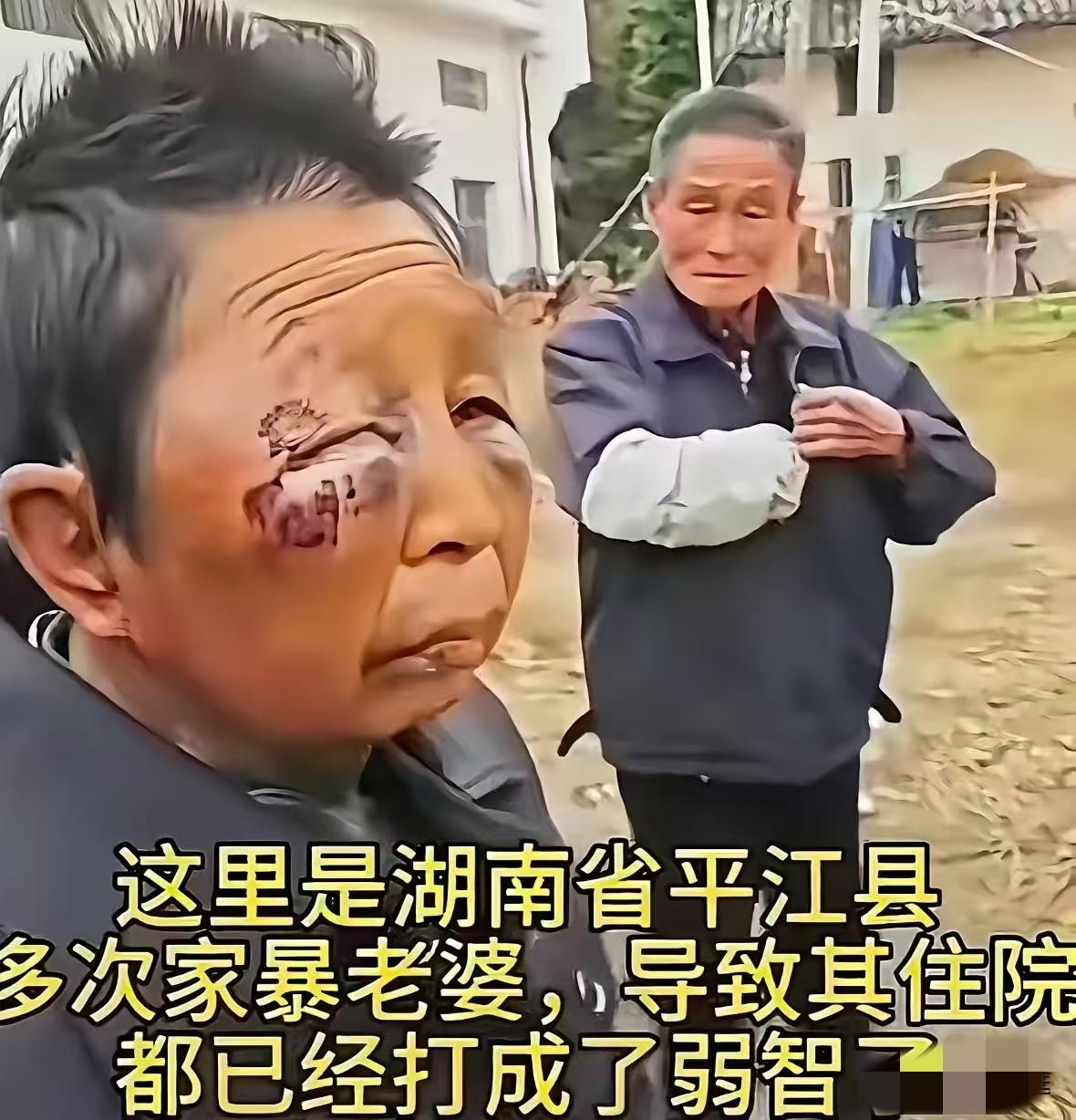 殴打妻子至耳朵变形的75岁老人名叫陈光明，他在村里口碑很差！村民坦言： 同一个小
