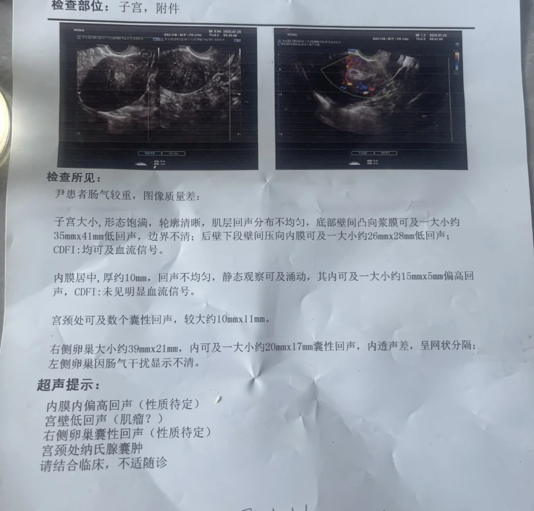 子宫肌瘤有恶性的吗 帮妈妈问