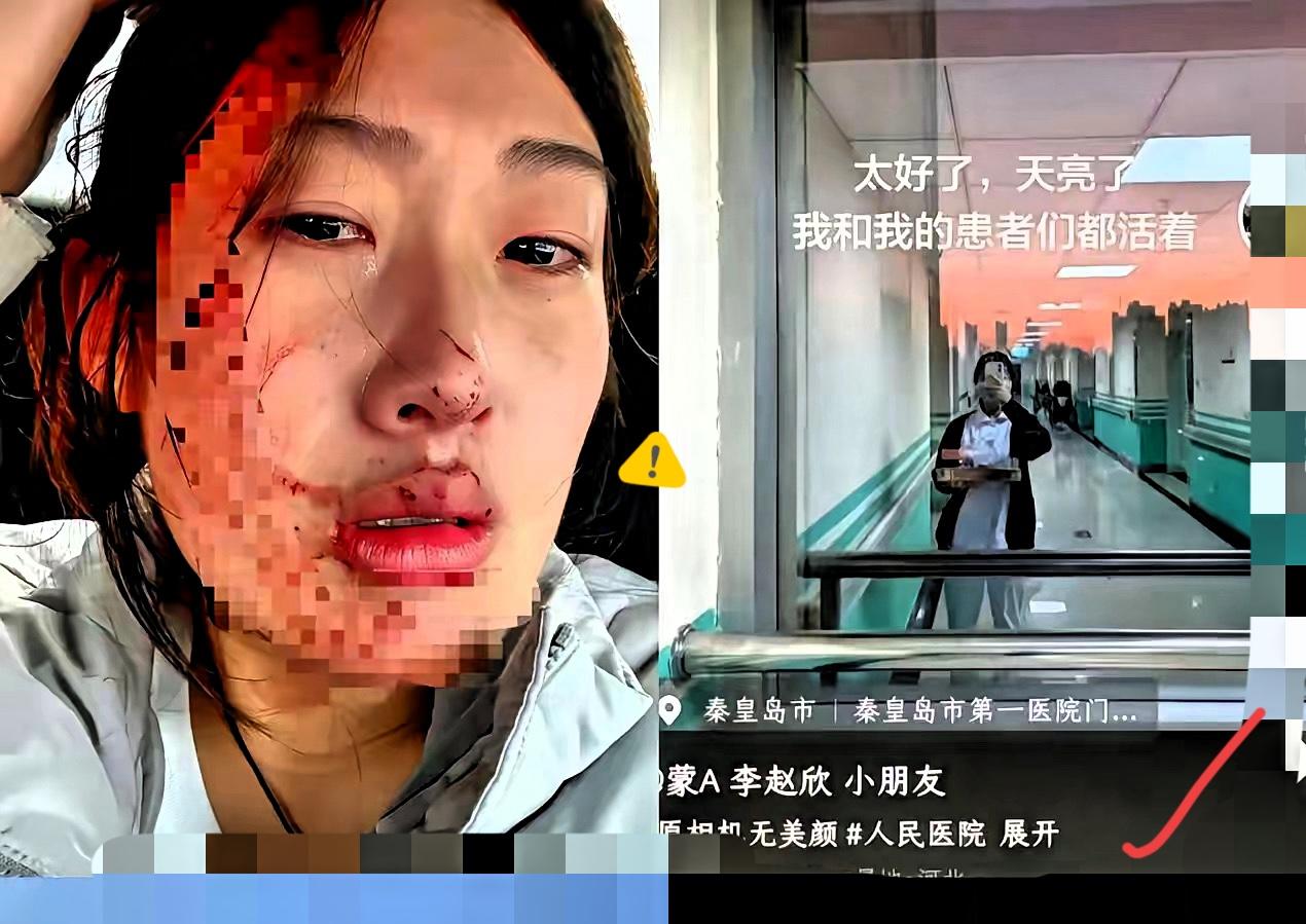 23岁护士被家长两拳砸成重伤，
这哪是心疼孩子，
分明是
借情绪作恶！

小儿扎