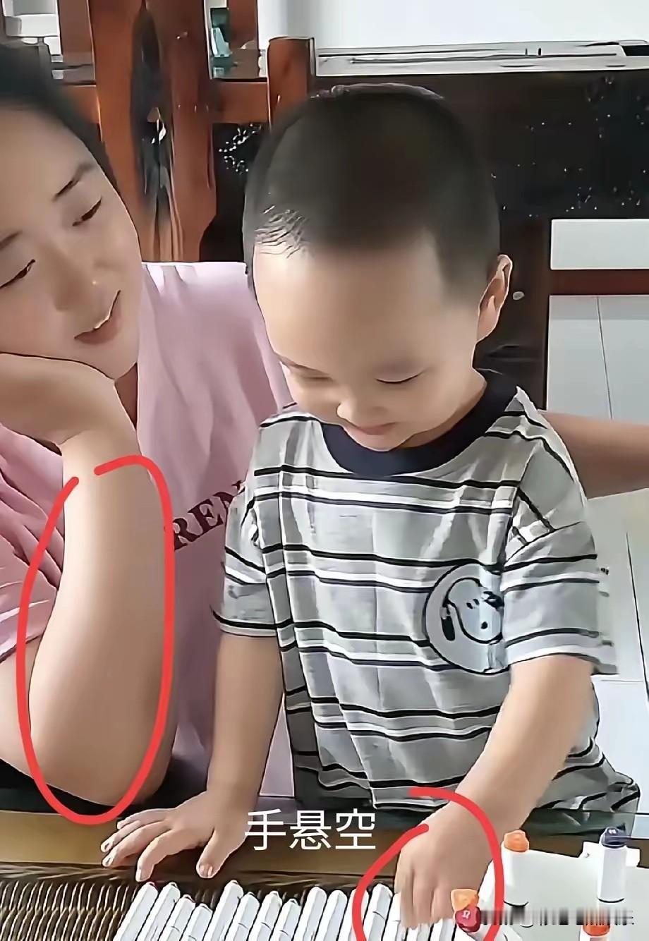 米乐妈妈终于出镜了，看着不像侏儒，不过因为美颜瘦脸开太大了，米乐的下巴尖得有点畸