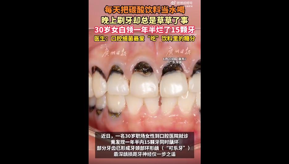 现在很多年轻人的续命神器，不是咖啡、不是奶茶，而是各式各样的碳酸饮料。
尤其是夏