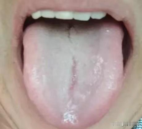 身体里是这样的湿热，你就算清十年也治不好

为什么这样说？湿热其实有很多种，这位