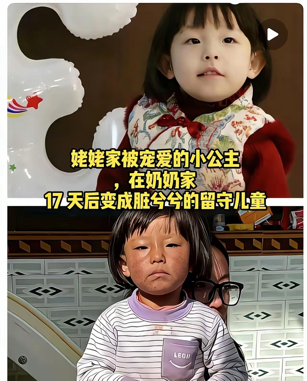 17天，涵涵从“小公主”变成“小可怜”，这反差看得人揪心到窒息！
 
17天前，