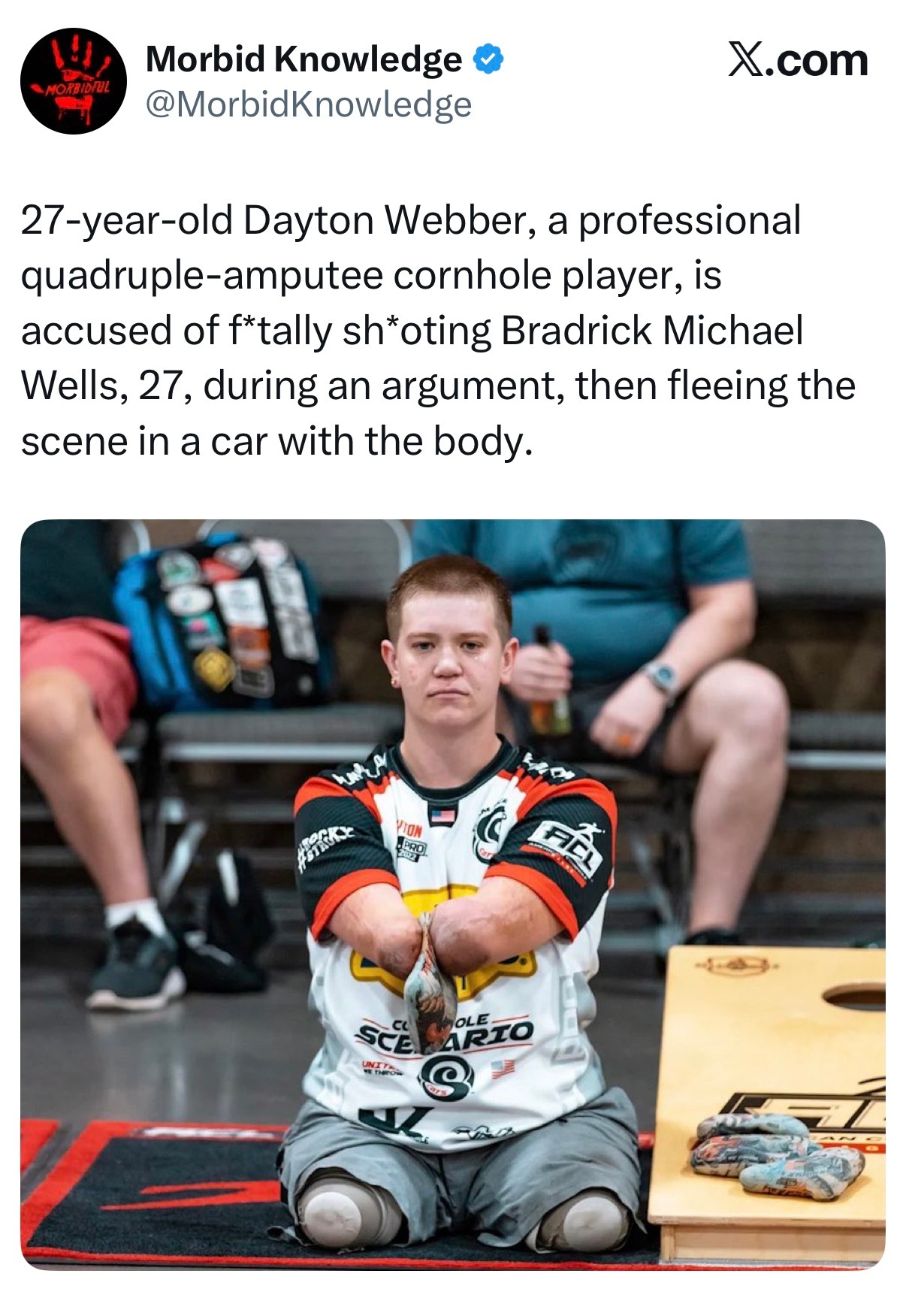 我以为是恶搞，居然是真的。“27岁的Dayton Webber，是一名职业“四肢