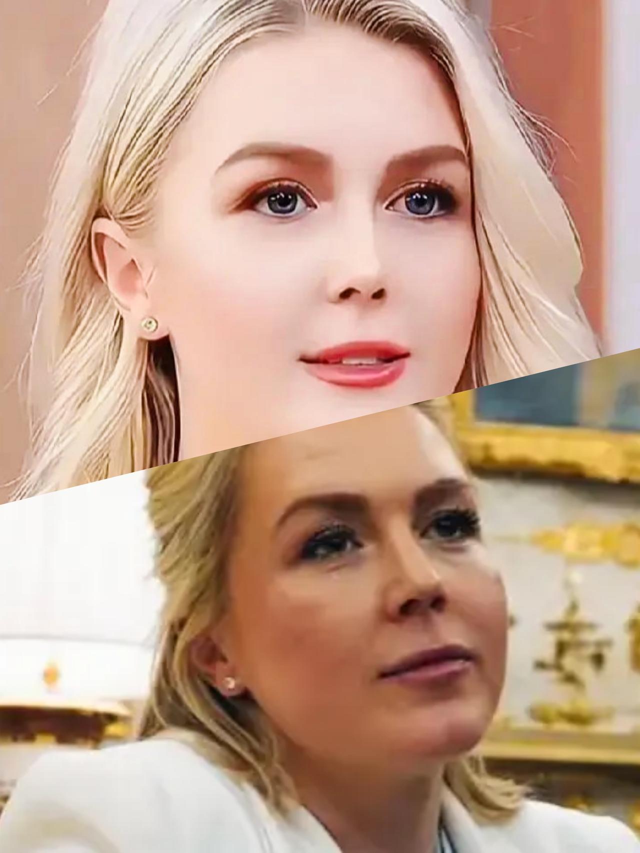 卡罗琳的颜值发生了这么大的变化，这是遭受了什么打击吗？
卡罗琳的颜值变化是不是有