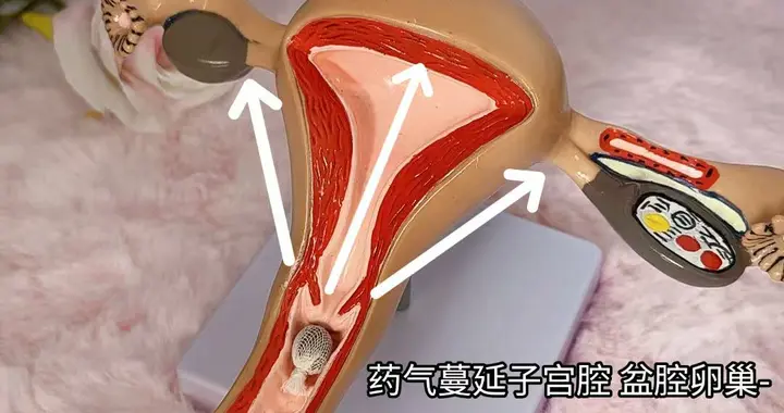 号称能排子宫毒素、月经残留，“清宫丸”涉嫌触碰多项法规红线