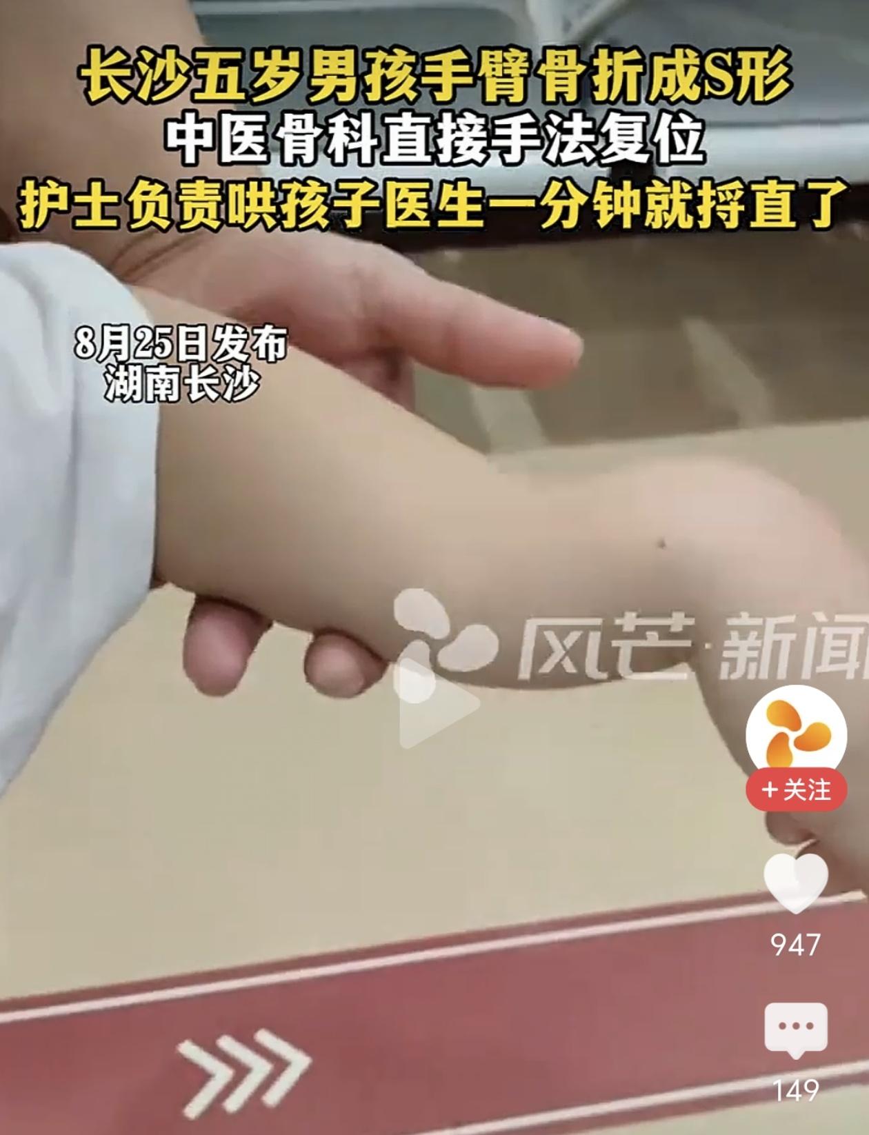 5岁男孩手臂摔成S形，中医正骨一分钟捋直，网友：这才是真功夫！

看着都疼！长沙
