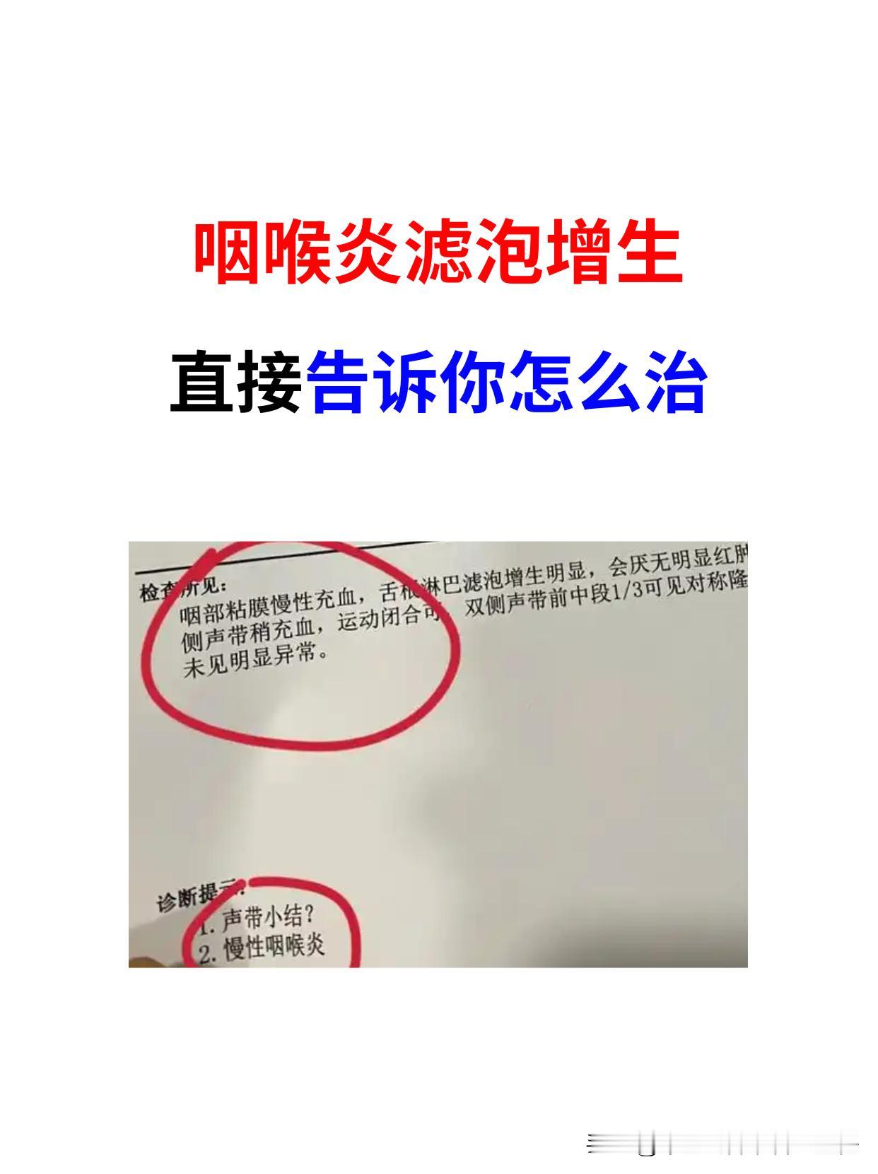 慢性咽喉炎淋巴滤泡增生别瞎治！对症这样治。
 
在我的门诊中，有一位名叫吴先生的