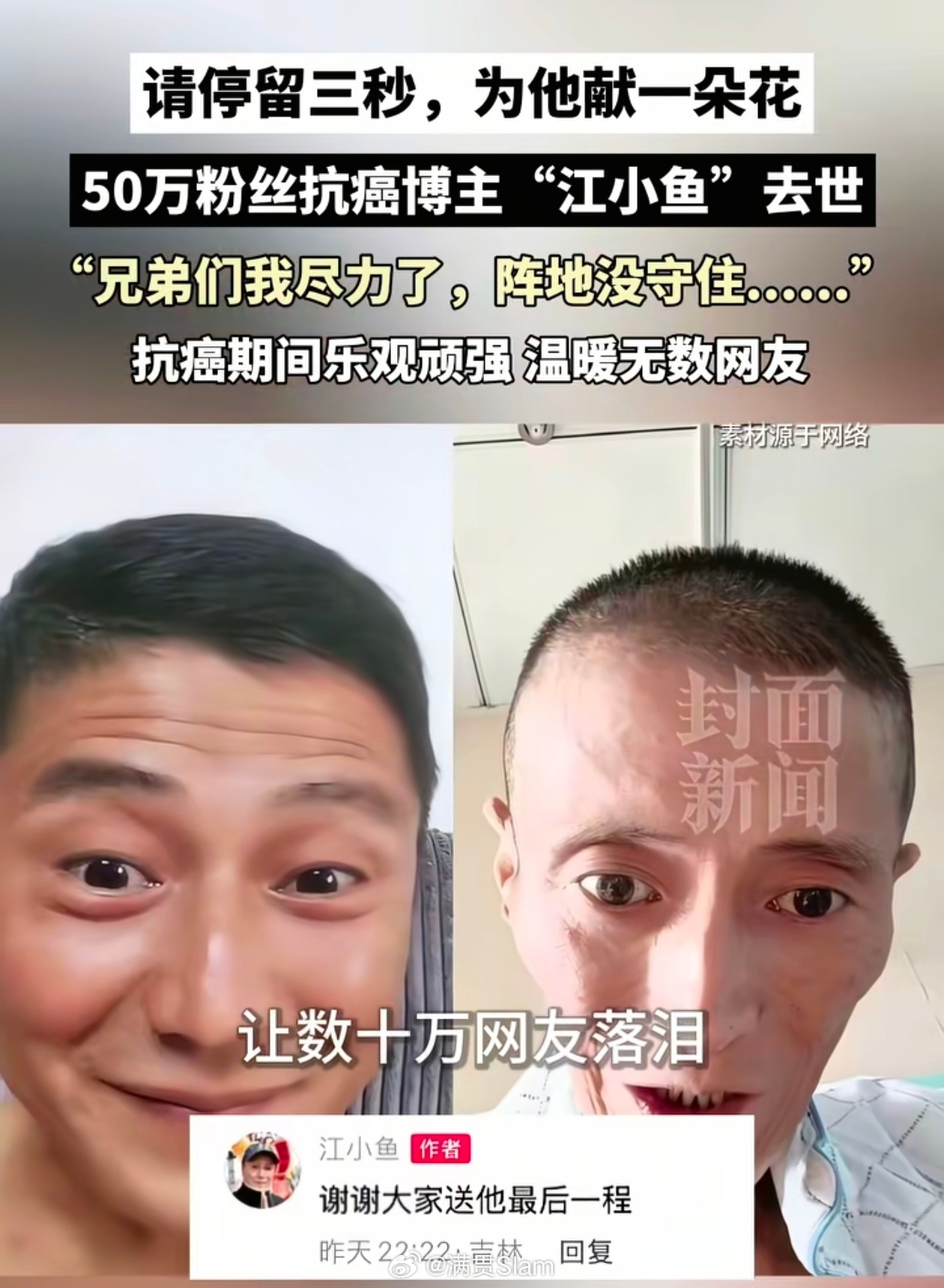 生前朋友回应抗癌博主江小鱼离世抖音上刷到过，前后对比叫人心酸。🙏愿天堂没有病痛
