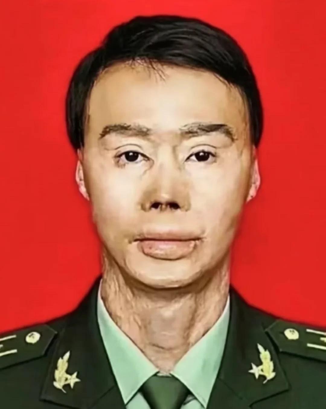 27名乘客得救了！
梁强在回家探亲途中突遇车祸现场救出24名乘客，却付出了全身烧