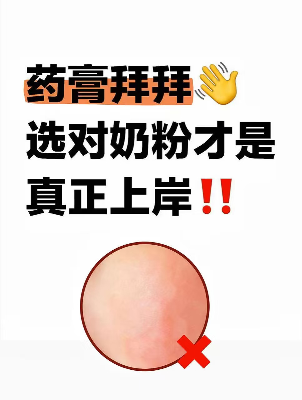 小敏感终于不挠脸了‼️多亏选对了这款奶粉