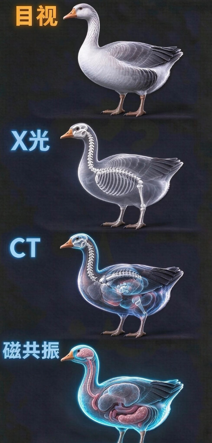 现在终于知道X光、CT、磁共振的区别了 ​​​
