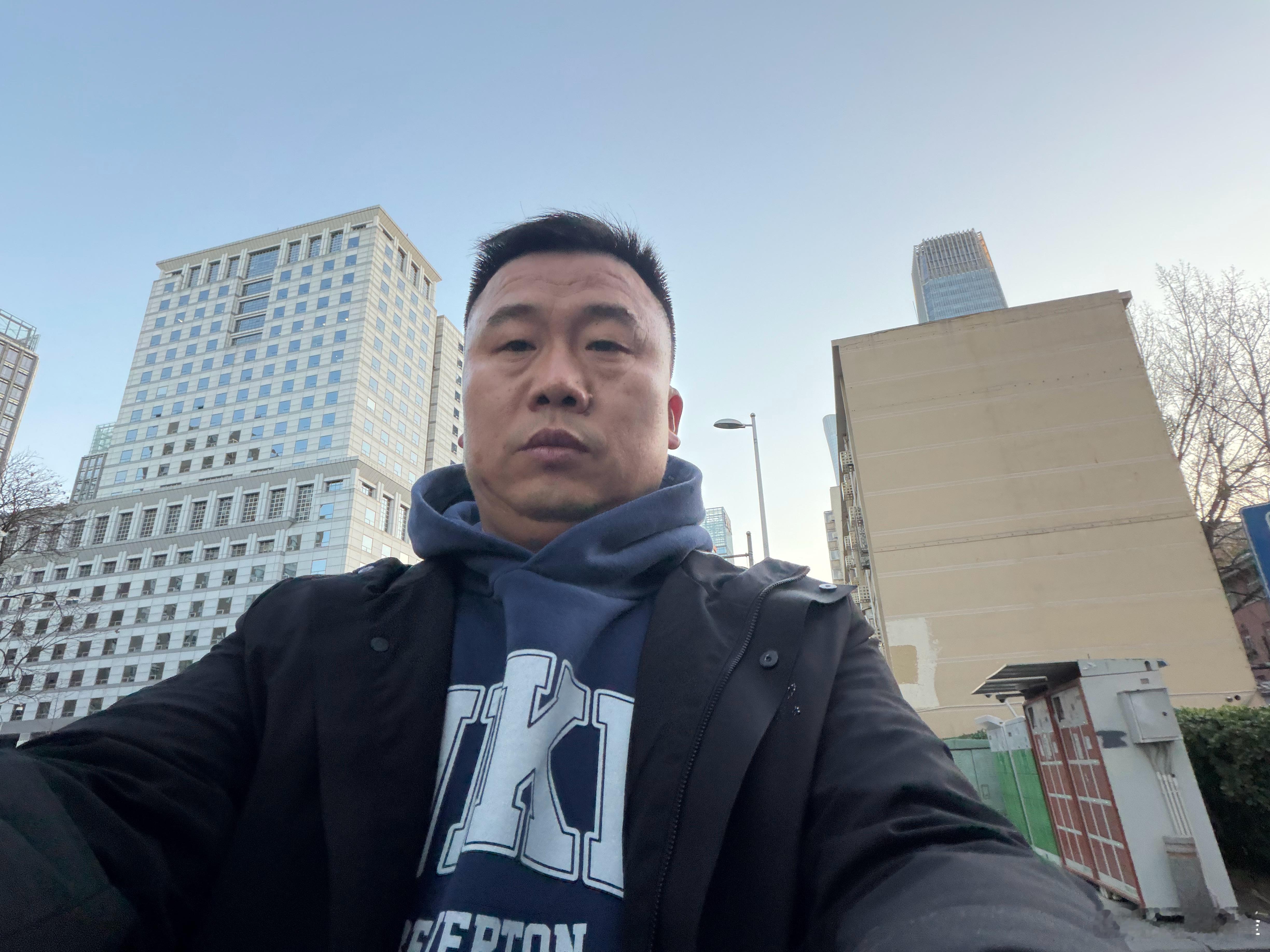 头发是不是多了？知道为什么吗？ 