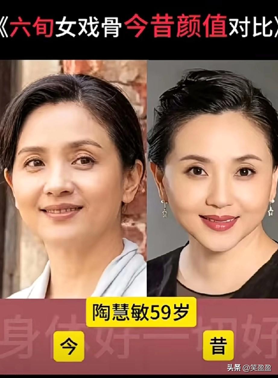 六旬女戏骨
今昔颜值对比？
你更喜欢谁？