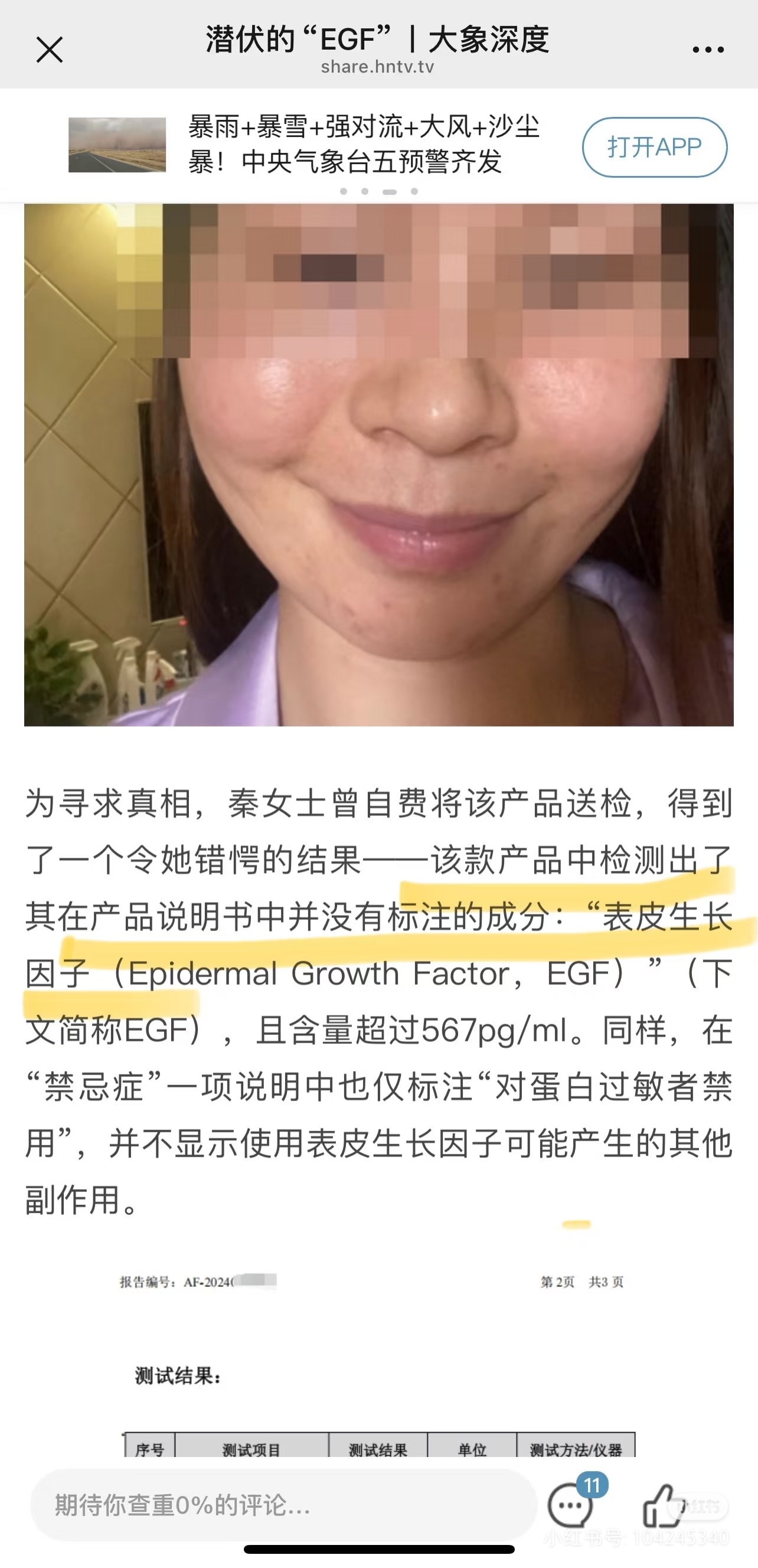 可复美西安秦女士（化名）于2023年使用该产品后出现面部肿胀、发硬等症状，就医后
