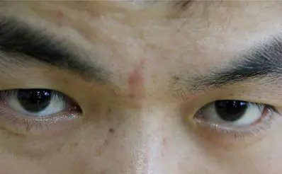 印堂斑点，直断破财！ 