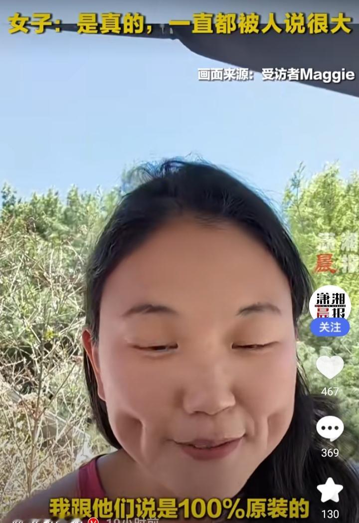 近日，网络上一则趣事引发了大家的关注。一位女子因拥有超大的酒窝，竟被网友怀疑是A