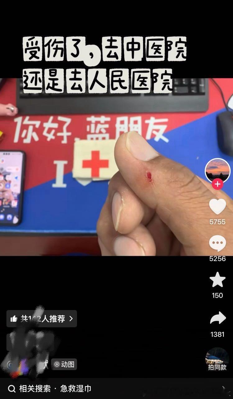 找王楚钦借片湿巾就可以了