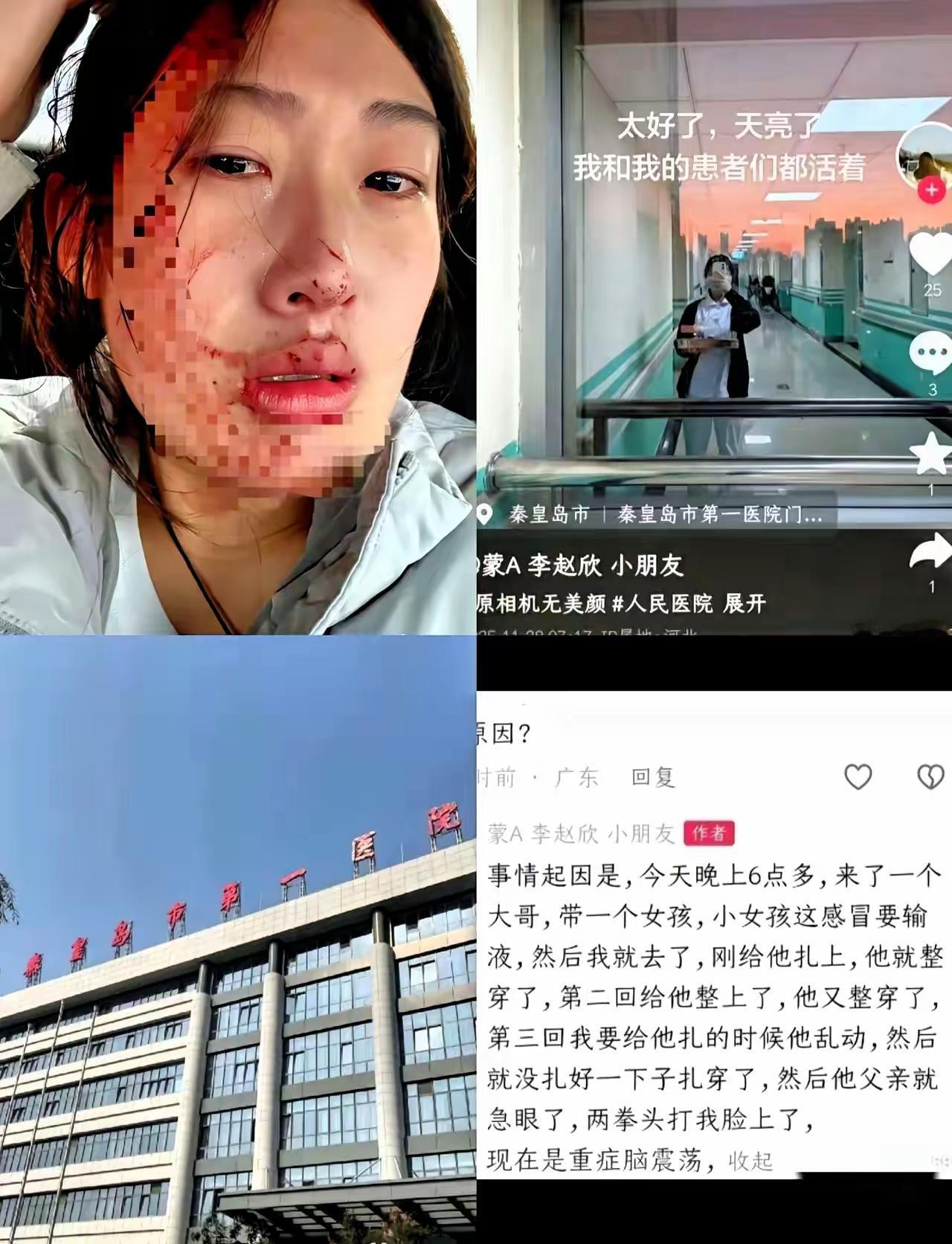 暴力人格果然要不得
​23岁女护士被打
​不是因为她技术不过硬，也不是因为她态度
