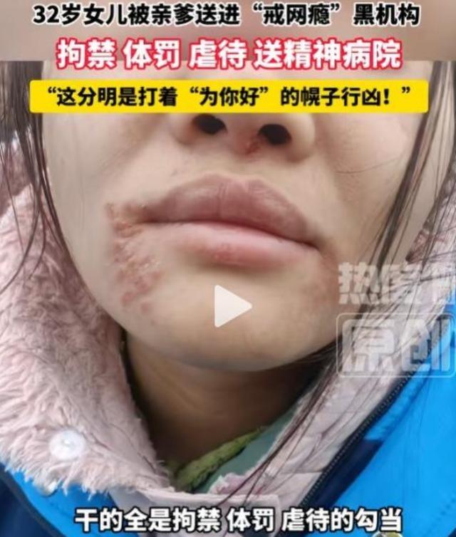 “口口声声为了你好”，实在荒唐！湖北一名父亲强行将32岁的成年女儿送入封闭式教育