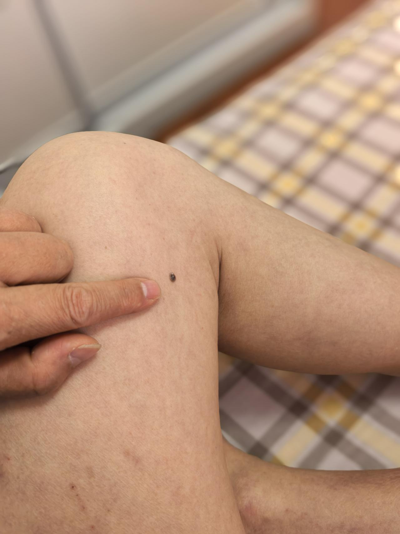 酒龄四十年，如今已经戒酒267天，全程滴酒未沾。
 
不知道是不是戒酒的缘故，这