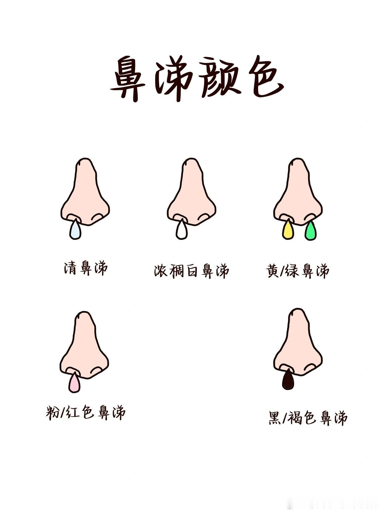 #不同颜色的鼻涕对应的症状# 不同鼻涕的秘密，通过观察鼻涕的颜色，我们可以了解身