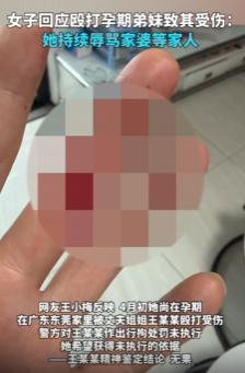广东东莞，一孕妇在自己家里跟丈夫的姐姐起了争执，拉扯间竟然被大姑姐一口咬伤了手指